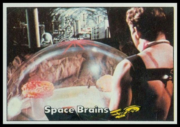 78 Space Brains